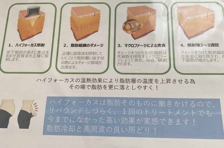 CBE2192C-80E5-402F-A5A9-9AF9E6309FEF