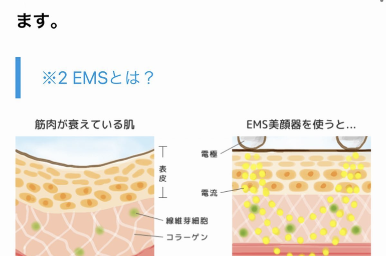 最新のハイフの上を行くマシーン